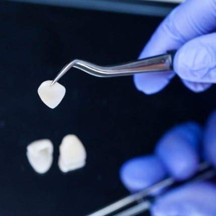 Metal free dental restorations prior to placement