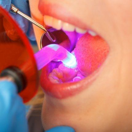 Dentistry patient receiving cosmetic dental bonding