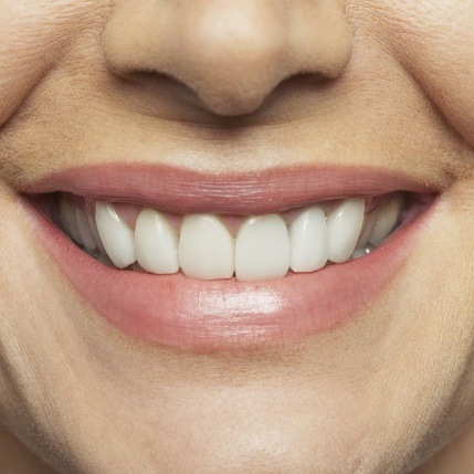 Closeup of smile after gum recontouring treatment