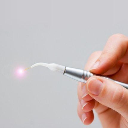 Hand holding a soft and hard tissue laser dentistry tool